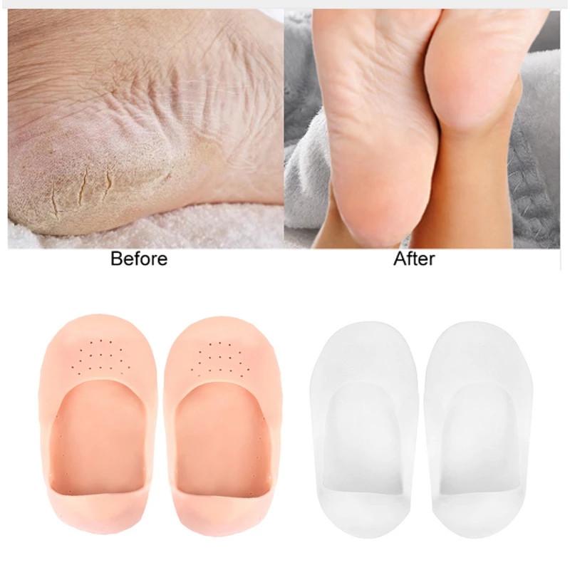 Toe Separating Gel Compression Socks Help Feet With Dry Cracked