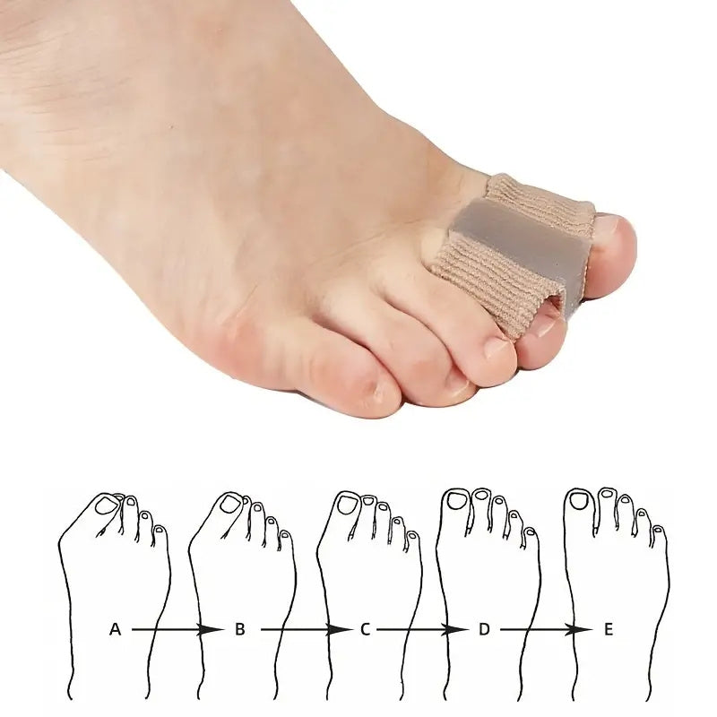 Silicone Gel Toe Spacer - Toe Dividers for Bunions - Toe Ring