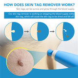 2-in-1 Auto Skin Tag Remover Kit
