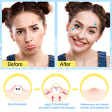 Acne Removal Pimple Patches