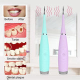 Electric Dental Calculus Plaque Remover Teeth Cleaner