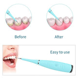 Electric Dental Calculus Plaque Remover Teeth Cleaner