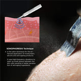 Electronial Ultrasonic Skin Scrubber Facial Pores Remover