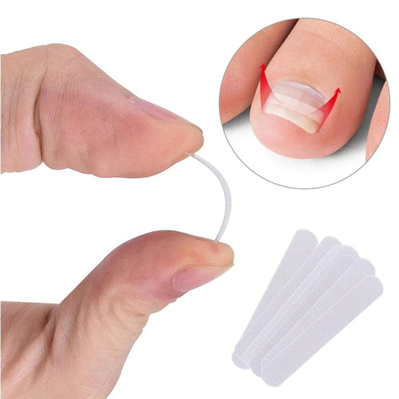 Ingrown Toe Nail Correction Sticker