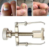 Ingrown Toenail Toe Fixer Recover Correction Device Pedicure Foot Nail Care Tool