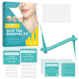 Wart or Skin Tag Remover Kit